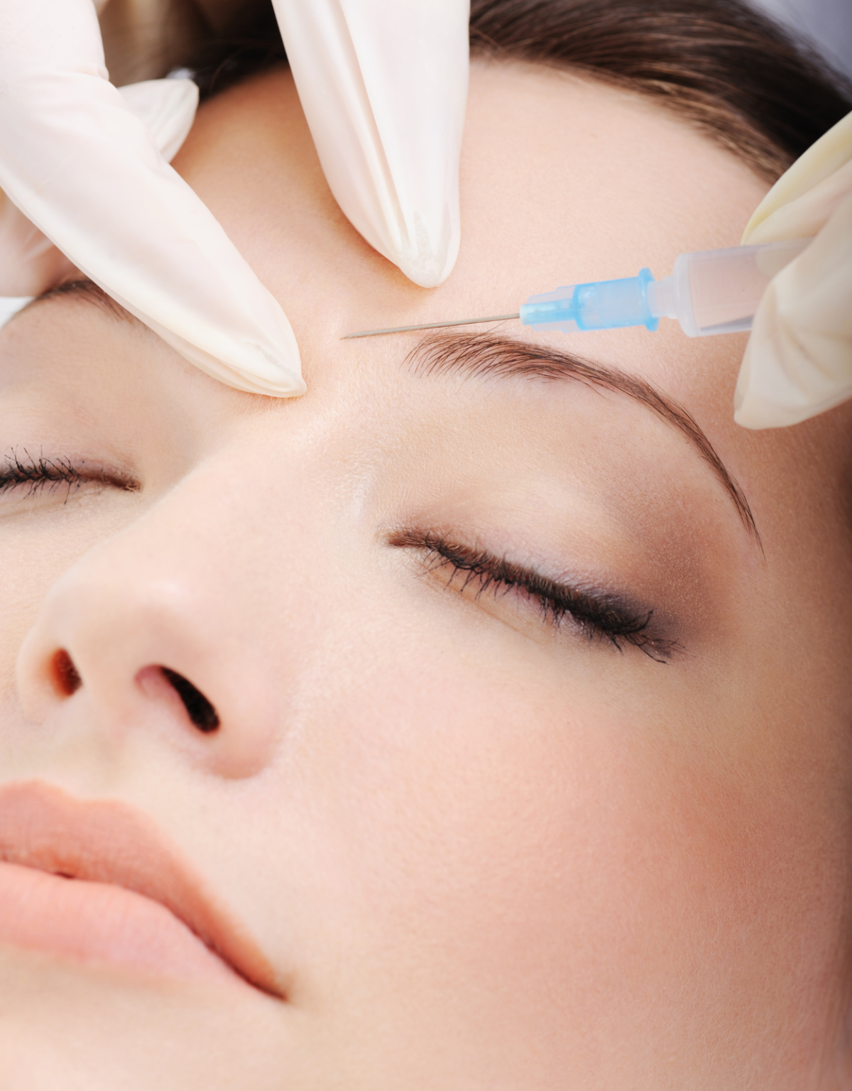 Sculptra in Portland, OR | Expert Biostimulatory Dermal Fillers