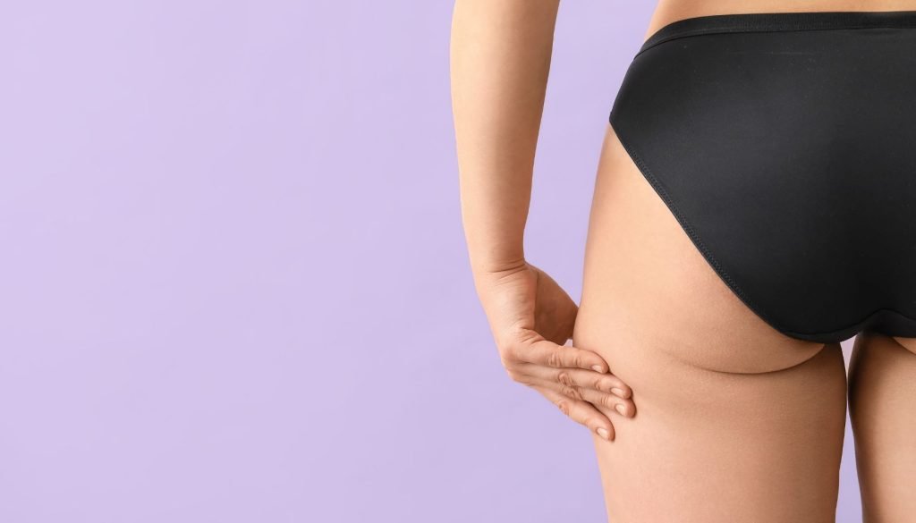 cellulite treatment