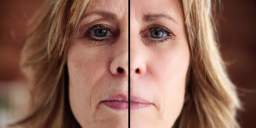 facial beaverton